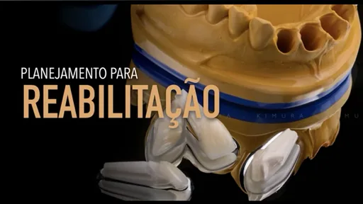 Planejamento para reabilitação