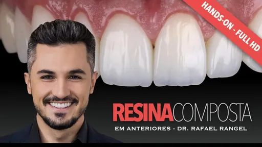 Resina composta em anteriores