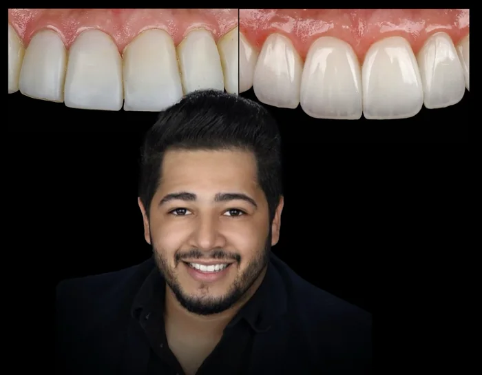 Caso e retrato de Erik Dyego